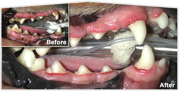 Dental Before/After